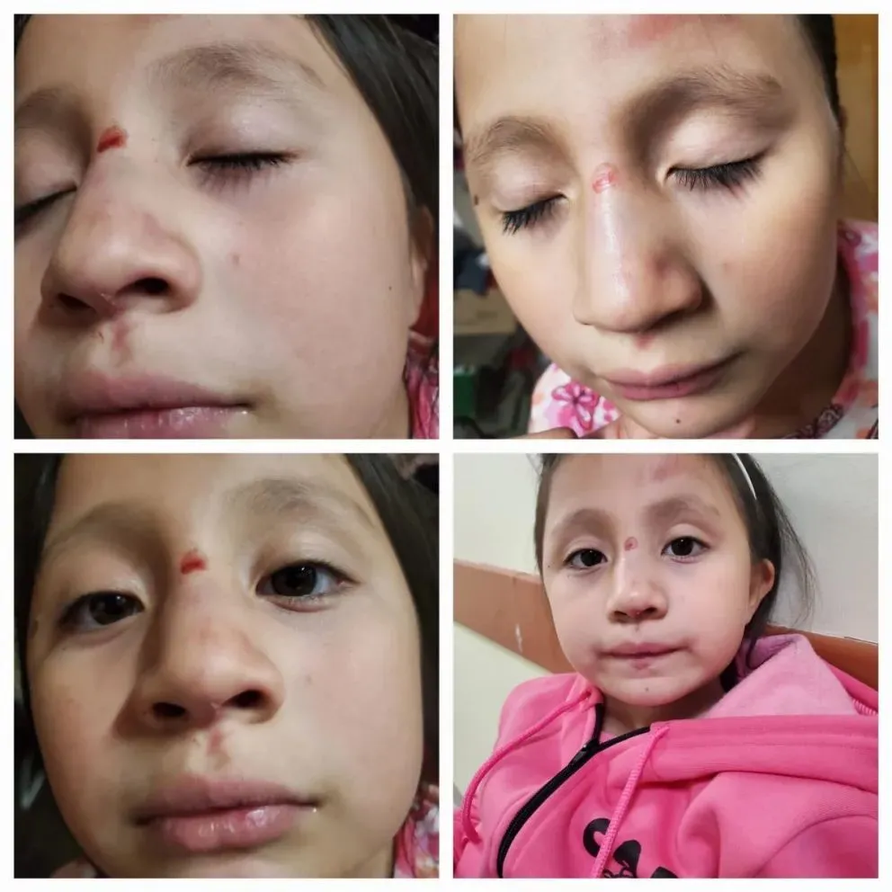 La familia esta ahora enfocada en la salud de la niña.