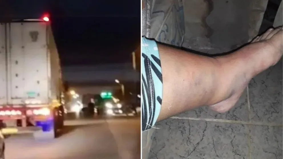 Vanesa quedó gravemente herida y a la espera de una operación más que urgente. (Foto gentileza)