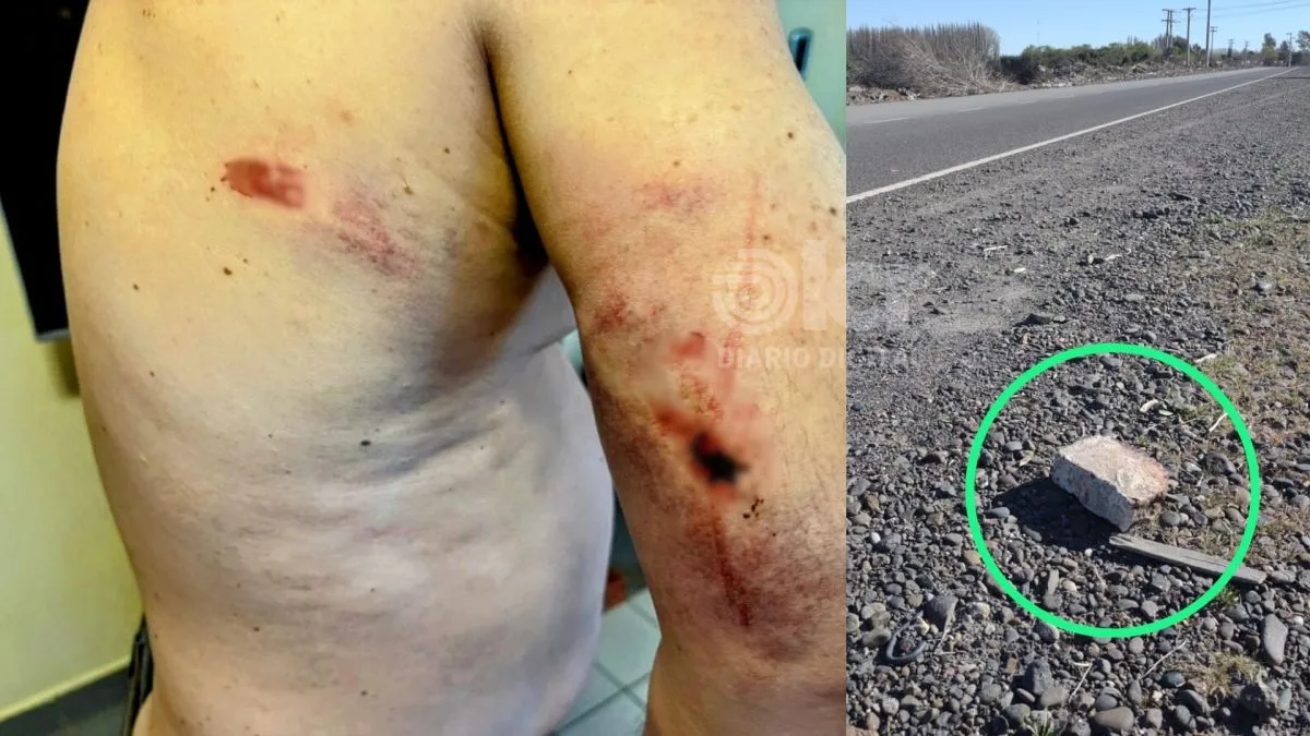 Fue atacado con un ladrillo. 