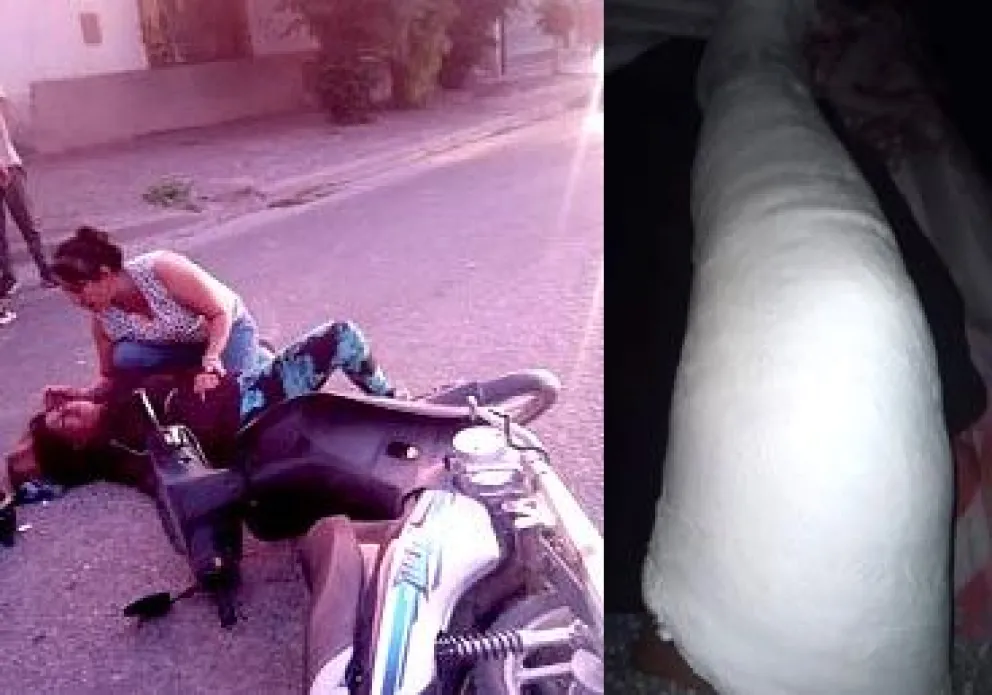 El insumo que Claudia necesita para su pierna tiene un costo de $1.500.000. Fotos gentileza.