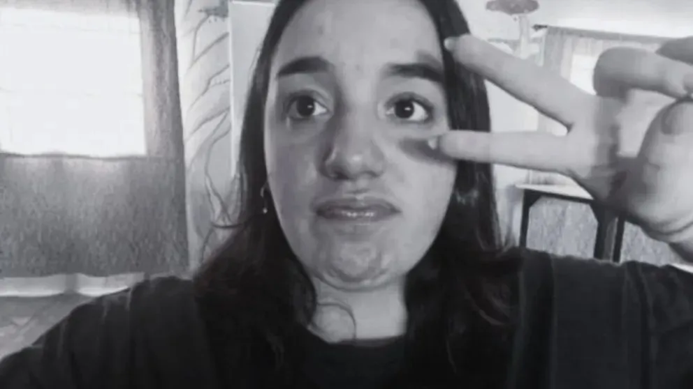 La joven de tan solo 17 años había logrado escapar del auto envuelto en llamas. Foto: gentileza