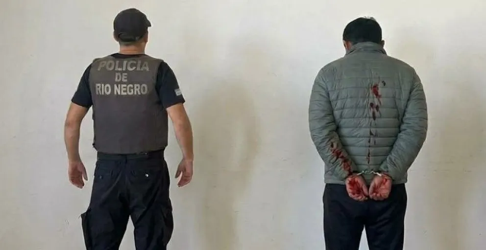 La detención ocurrió ayer a partir del conflicto ocurrido en el interior de una propiedad en calle Trevisan. Foto Policía RN. 